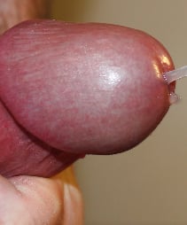 terael