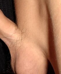 Scrotumfuzz